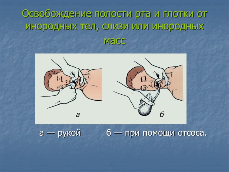 Освобождение полости рта и глотки от инородных тел, слизи или инородных масс  